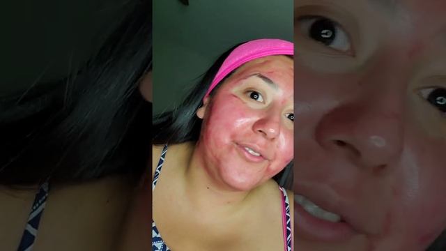 The Ordinary. AHA 30% + BHA 2% Peeling Solution | Liz Quiroz