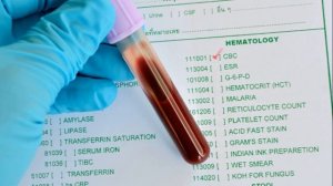 БИОХИМИЧЕСКИЙ АНАЛИЗ КРОВИ | Как расшифровать биохимический анализ крови норма показателей