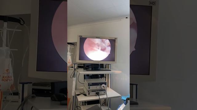 Гистероскопия. Как проходит?