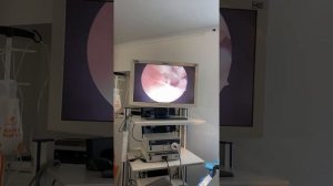 Гистероскопия. Как проходит?