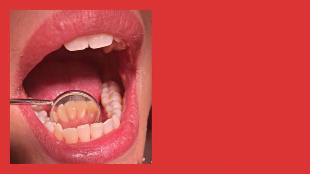 Профессиональная гигиена зубов во Пскове смотреть онлайн