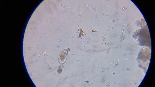 Бактерии под микроскопом.