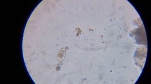 Бактерии под микроскопом.