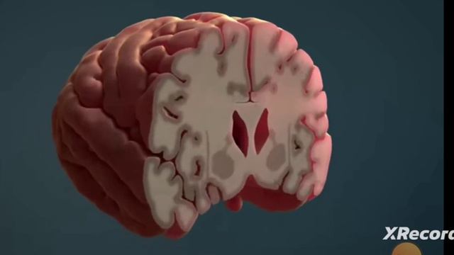 Нервная система Человека. Мозг. смотреть онлайн