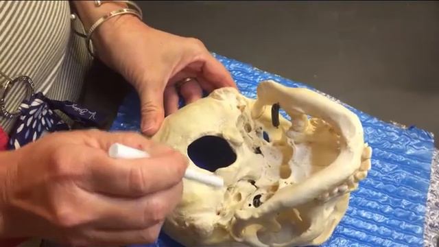 Human Skull - Inferior View смотреть онлайн