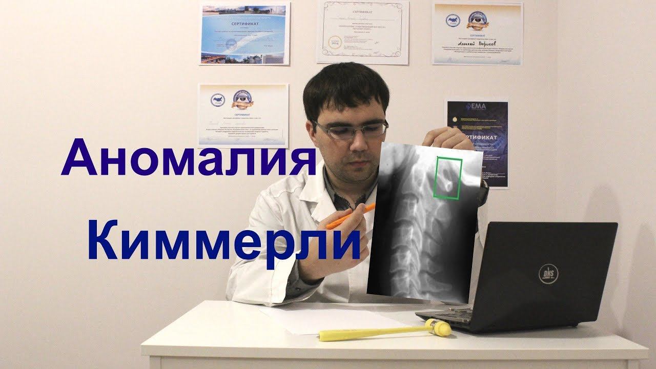 Аномалия Киммерли смотреть онлайн