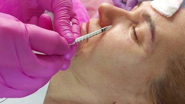 Токсин. Элементы техник.