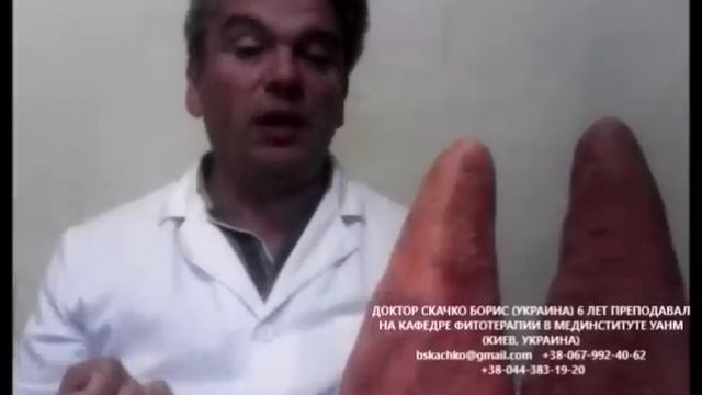 как правильно жевать-пережевывать и готовить пищу? советы диетолога Скачко как правильно питаться смотреть онлайн