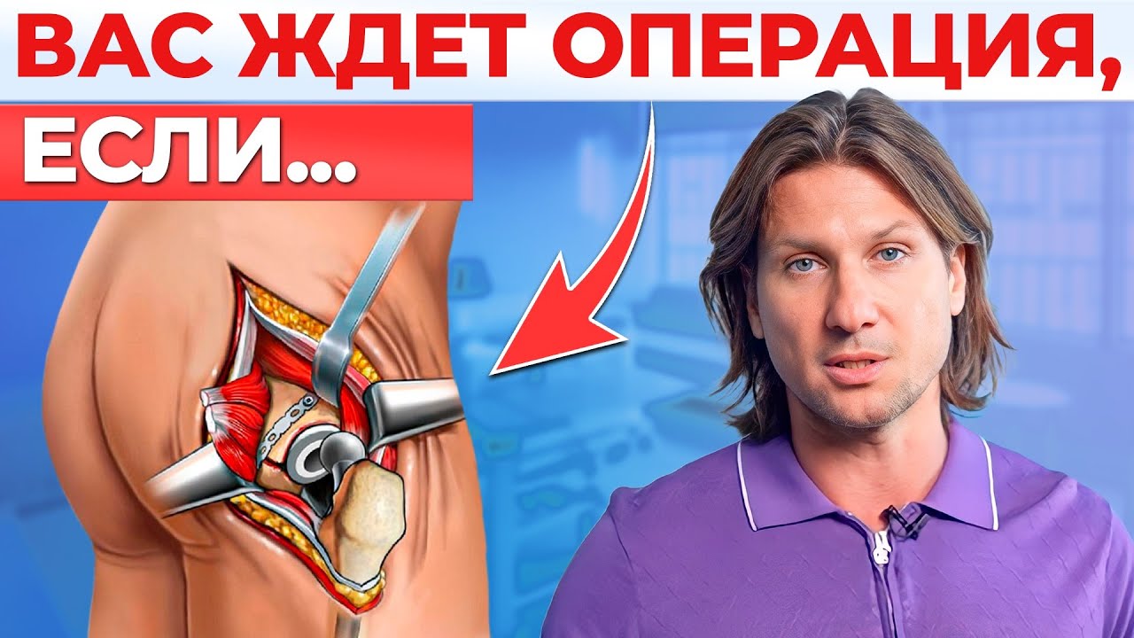 ЭТО чаще всего ЗАМЕНЯЮТ в нашем теле. Главные мифы про тазобедренный сустав