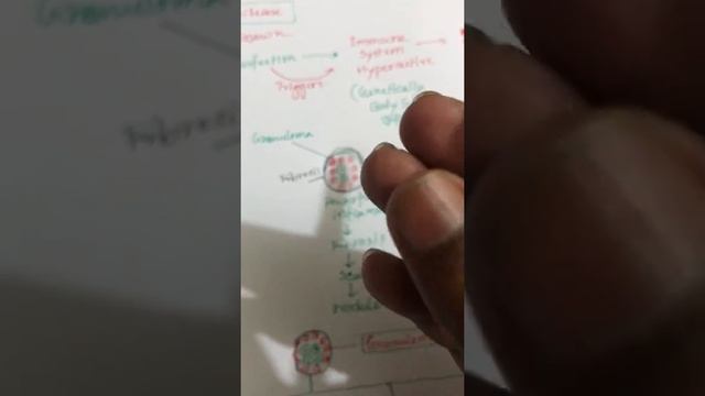 Sarcoidosis Pathology & Clinical Features смотреть онлайн