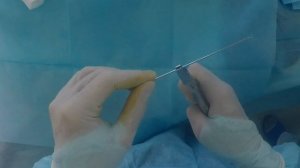 Самое не травматичное лечение перелома.   Перелом 5 пястной кости (перелом драчуна)