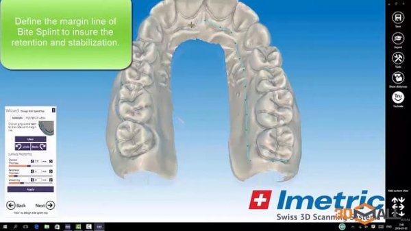 Bite splint module - модуль шинирования зубов