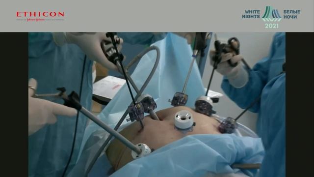 White Nights Congress 2021 live surgery TME vs TME + lateral Lymph Node dissection смотреть онлайн
