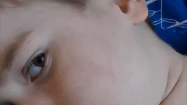Ювенильный дерматомиозит © juvenile dermatomyositis смотреть онлайн
