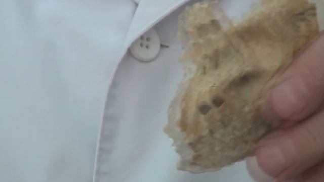 Каналы височной кости. Лекция по анатомии. смотреть онлайн