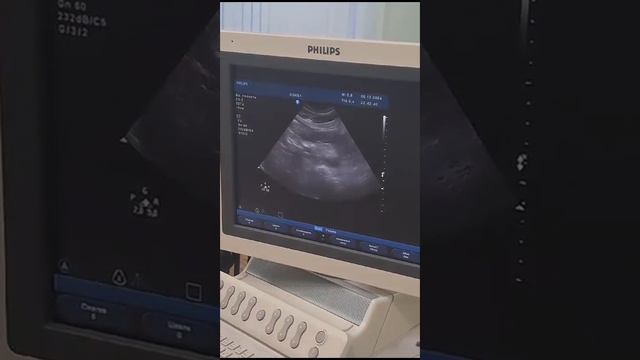 аккредитация УЗИ поджелудочной железы смотреть онлайн