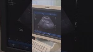 аккредитация УЗИ поджелудочной железы