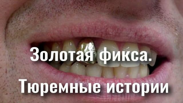 Как мне ставили фиксу на зоне. Тюремные истории смотреть онлайн