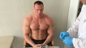 Лечение хронической спортивной травмы плеча