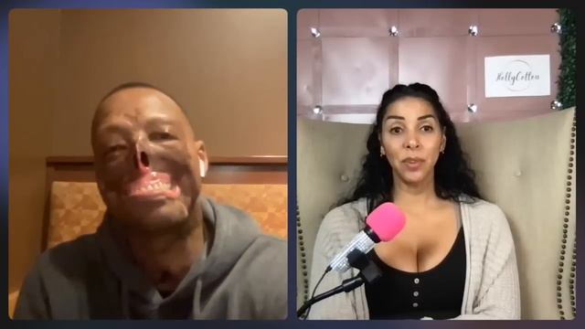 Randy Adams Talks Life After Losing Your Face And How He Learned To Love Himself Again With RISEUP