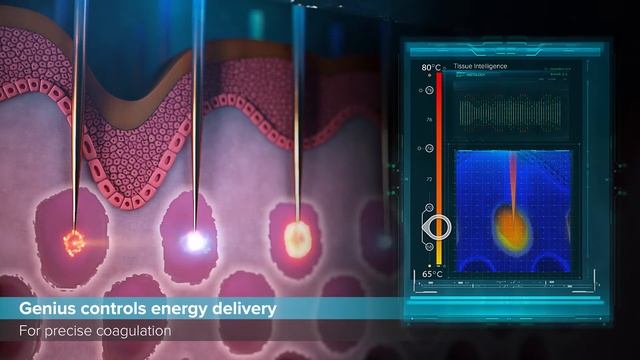 Introducing Infini Genius by Lutronic смотреть онлайн