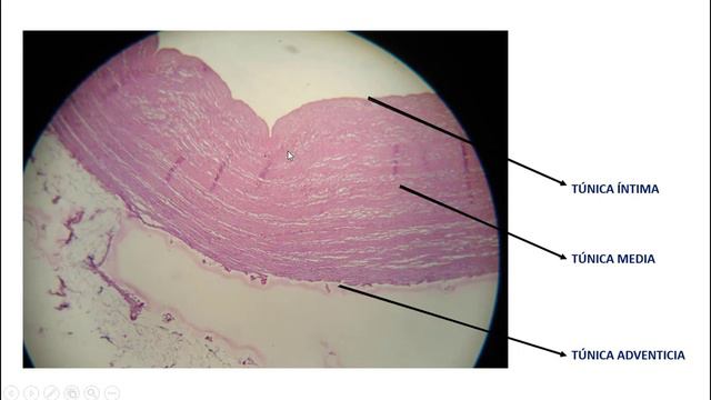 Histología de la Aorta смотреть онлайн