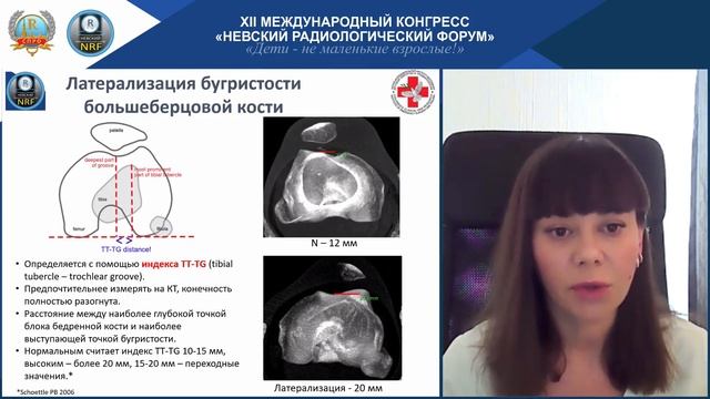 НАУЧНАЯ ШКОЛА «Лучевая диагностика скелетно-мышечной системы у детей». смотреть онлайн