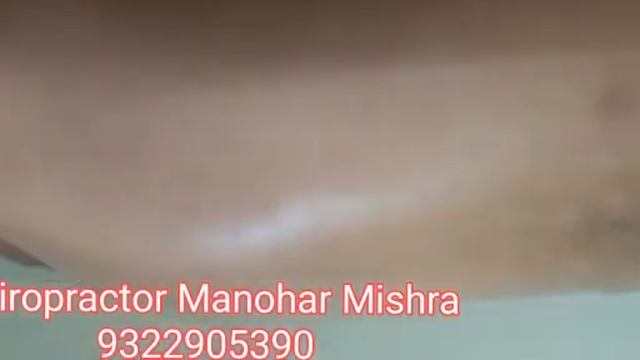 Scolosis treatment Hunch back Correct Spine Alignment in 21 days Chiropractor Manohar Mishra Mumbai смотреть онлайн