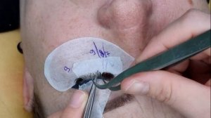 ВОЗРАСТНОЕ НАРАЩИВАНИЕ РЕСНИЦ.  НАВИСШЕЕ ВЕКО НАРАЩИВАНИЕ РЕСНИЦ СХЕМА