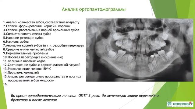 Обследование ортодонтического пациента. Диагностика в ортодонтии