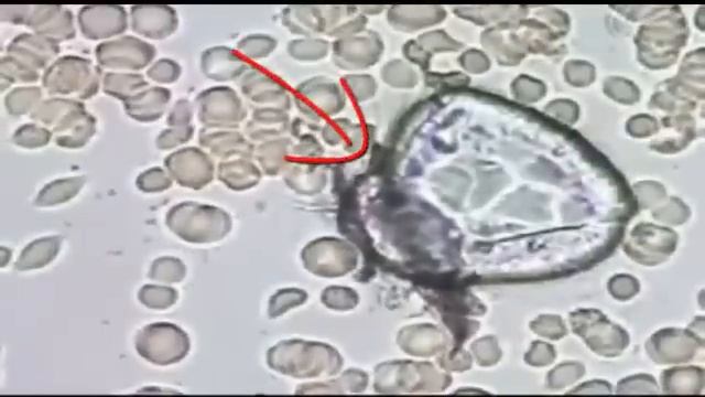 Паразиты - Лямблии