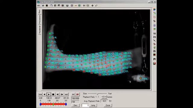 Impact analysis leads to improved treatment for injuries смотреть онлайн