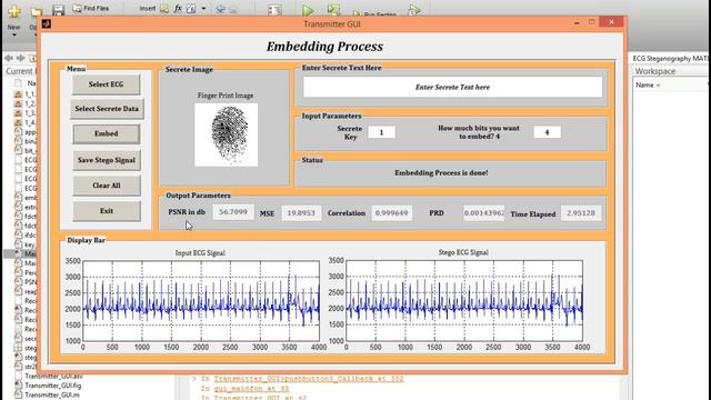 ECG Steganography matlab project source code смотреть онлайн
