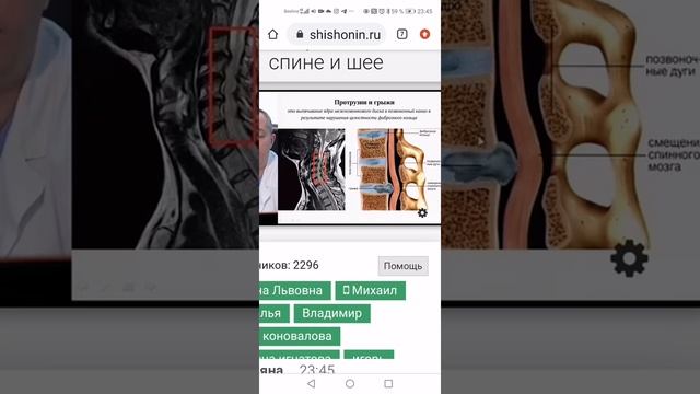 Шошонин остеох