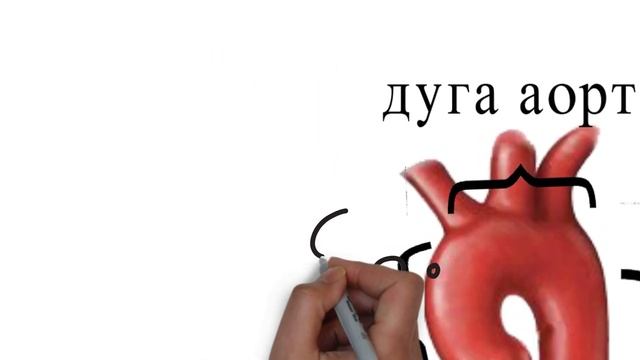 Аорта смотреть онлайн