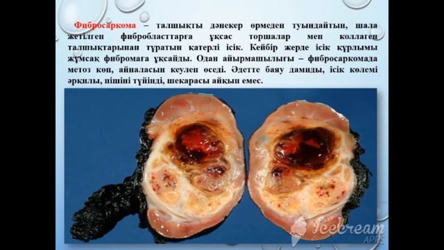 Талдықорған агро-техникалық колледжі Абдыгапарова Айгерім Нығметқызы смотреть онлайн