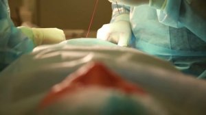 Лигаментотомия отзывы и цена