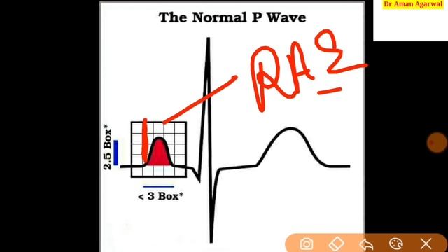 ECG report कैसे देखते है || Electrocardiogram explanation in hindi language смотреть онлайн