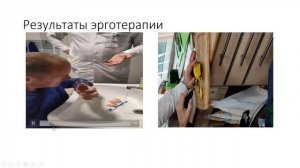 Ишемический инсульт