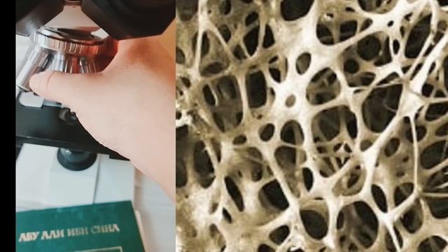 ЭНГ ЯХШИ АРЗОН КАЛЬЦИЙ МАНА У ОДАМ СУЯГИ БИЛАН БИР ХИЛ ТУЗИЛИШДА / ХАМ СИФАТЛИ ХАМ ТАБИИЙ смотреть онлайн