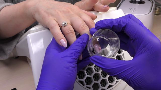 Ошибки в снятии при отслойках смотреть онлайн