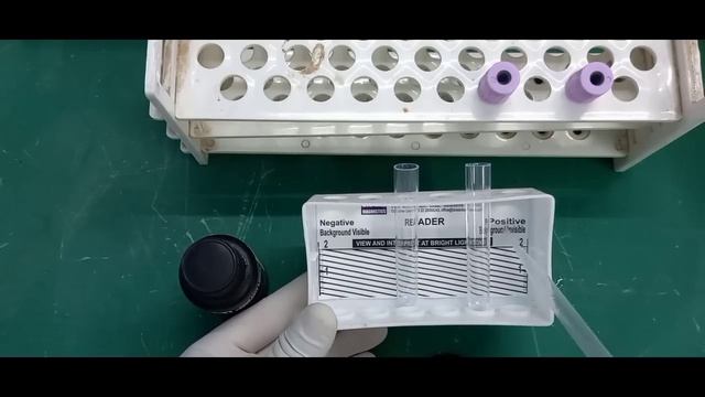 Rapid Sickle Cell Solubility Test | Dithionate Qualitative Solubility Test | Practical Video смотреть онлайн