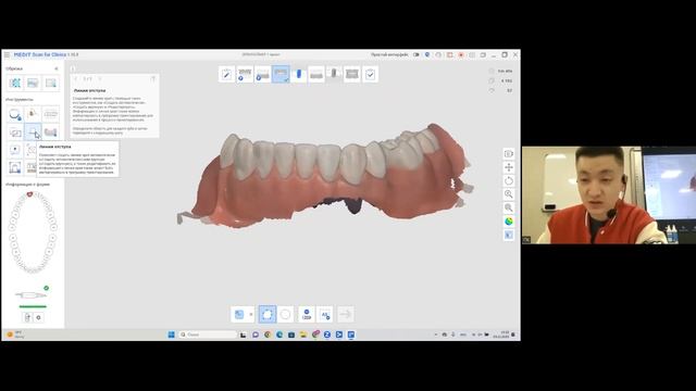 Обзор интраорального сканера Medit i700. ВВЕДЕНИЕ смотреть онлайн