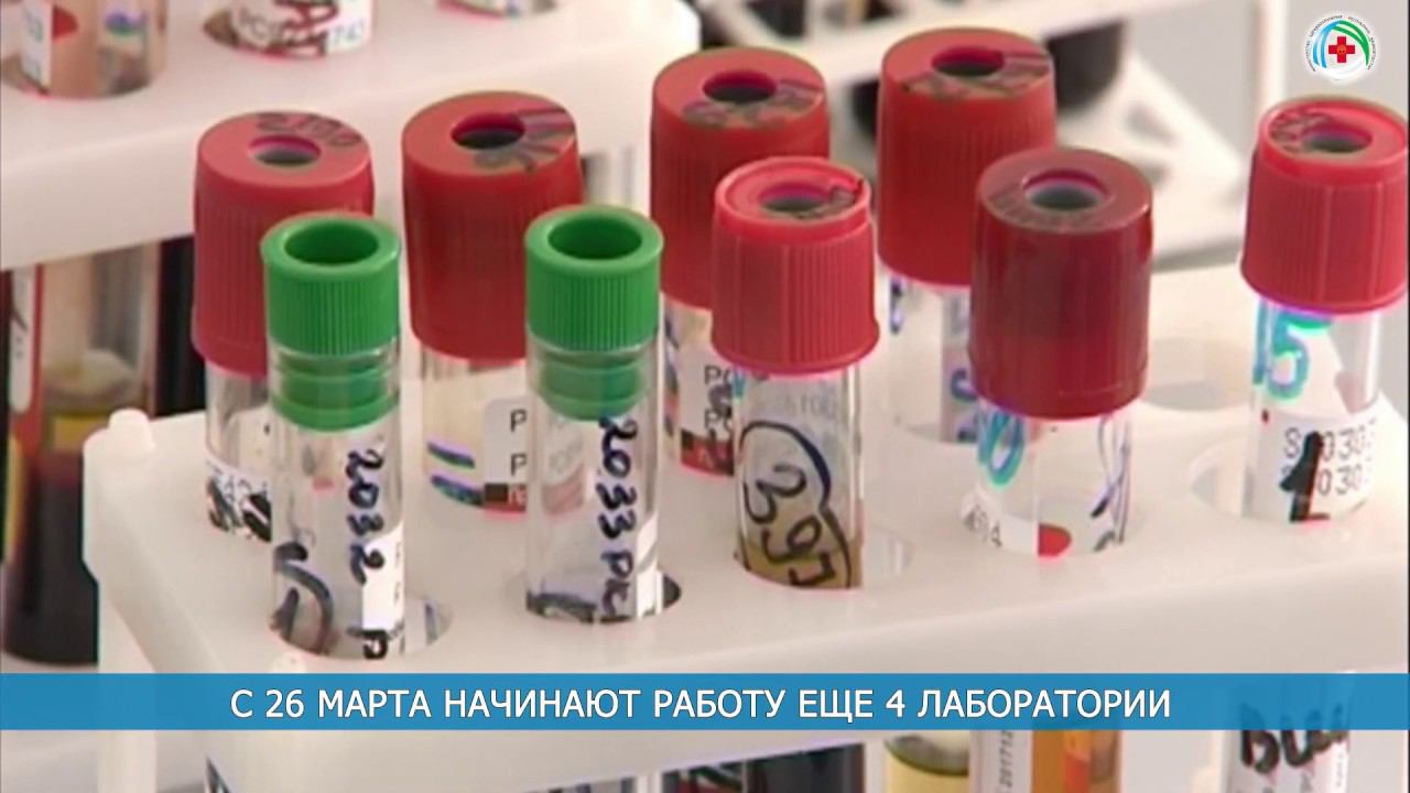 Коронавирусная инфекция COVID‑19 смотреть онлайн