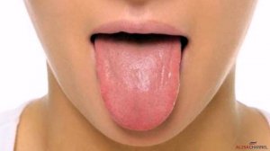 10 способов как избавится от икоты