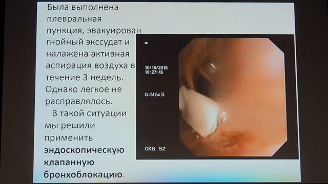 07 Бархатова ИВ Клапанная бронхоблокация при бронхоплевральном свище смотреть онлайн