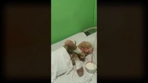 Мой сын словно ГНИЁТ ЗАЖИВО, "ЧЕШУЯ" вместо кожи / Синдром KID, Ихтиоз