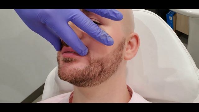 My First Lip Filler Experience | Juvederm Ultra XC смотреть онлайн
