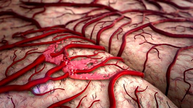 A Silent Threat. 8 Clear Signs That Can Indicate Fatty Liver Disease смотреть онлайн