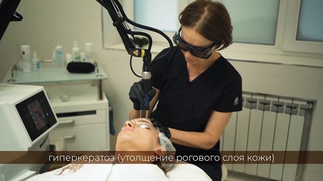 Лазерный пилинг на аппарате Dermablade MCL31 смотреть онлайн